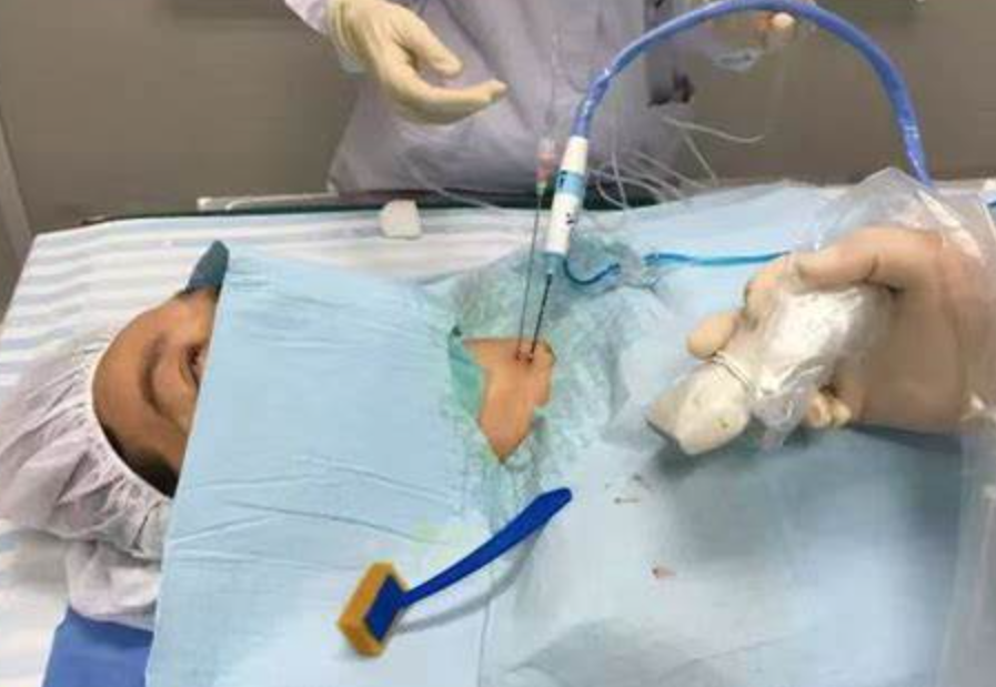 甲状腺结节是否需要手术治疗？(图1)