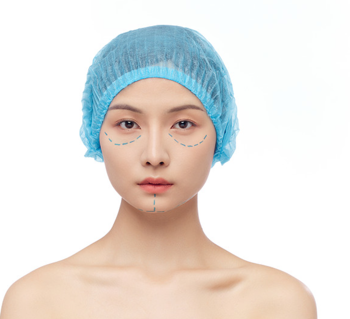 微整形：轻松变美还是潜在风险？(图1)