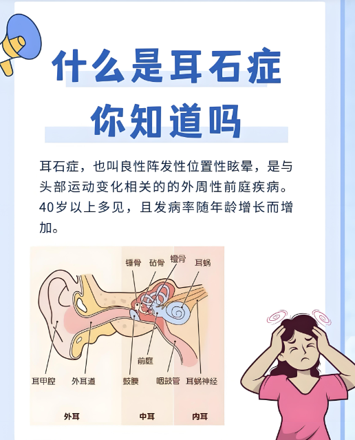 耳朵里的小石头怎么“搬家”？耳石症治疗的妙招(图1)