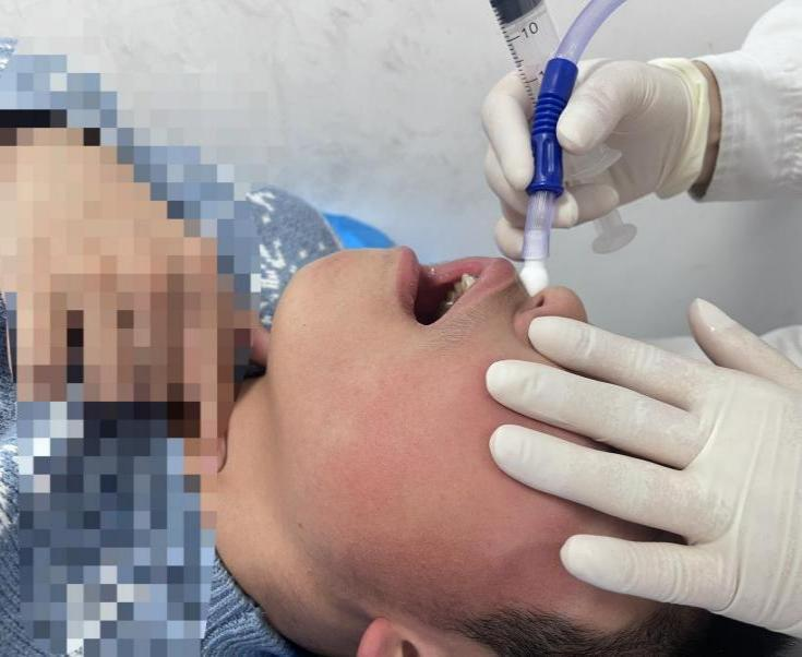 解锁大鼻孔如何配合鼻负压置换技术?(图6)