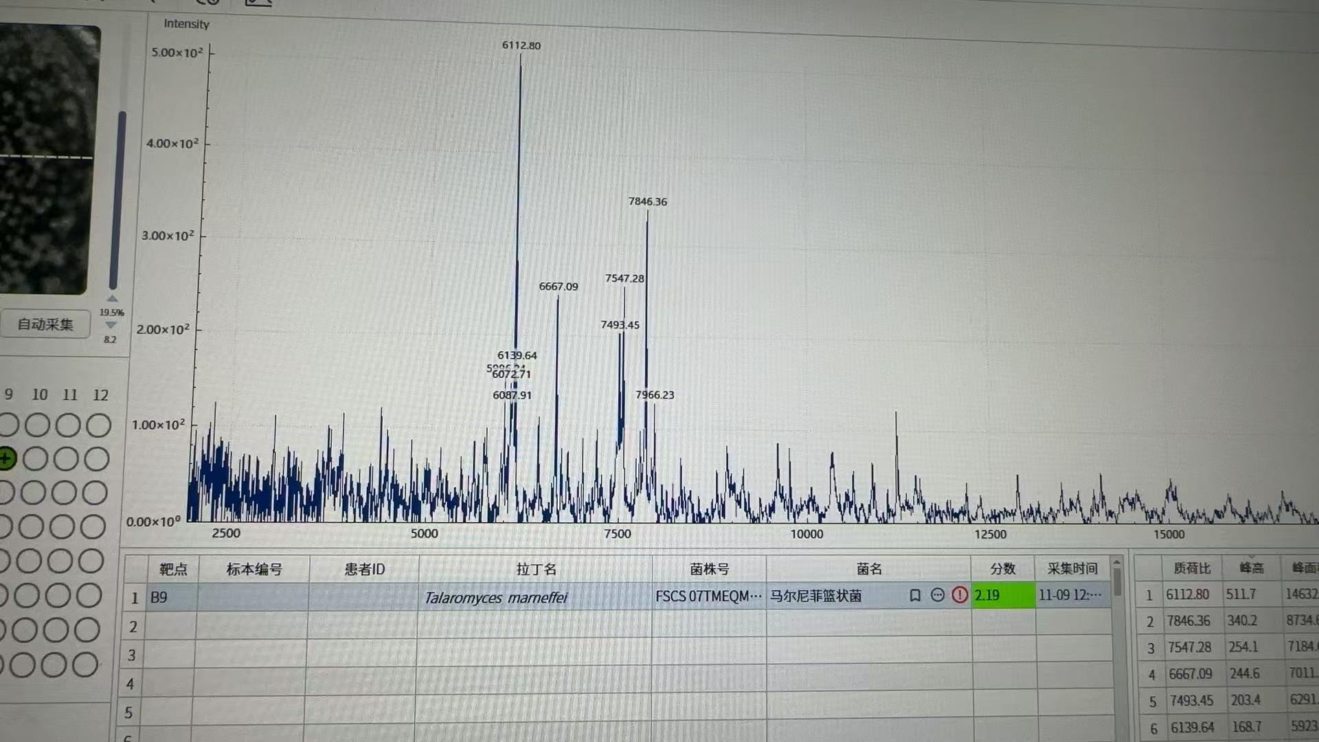 从血培养到诊断警报，检验科如何识别马尔尼菲青霉？(图2)