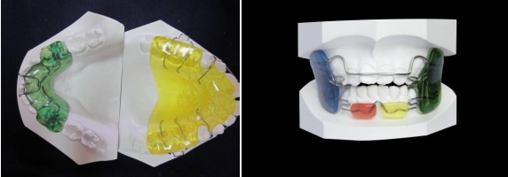 儿童早期矫治的选择和误区(图3)