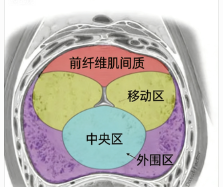 关于前列腺护理，这些知识要了解(图2)